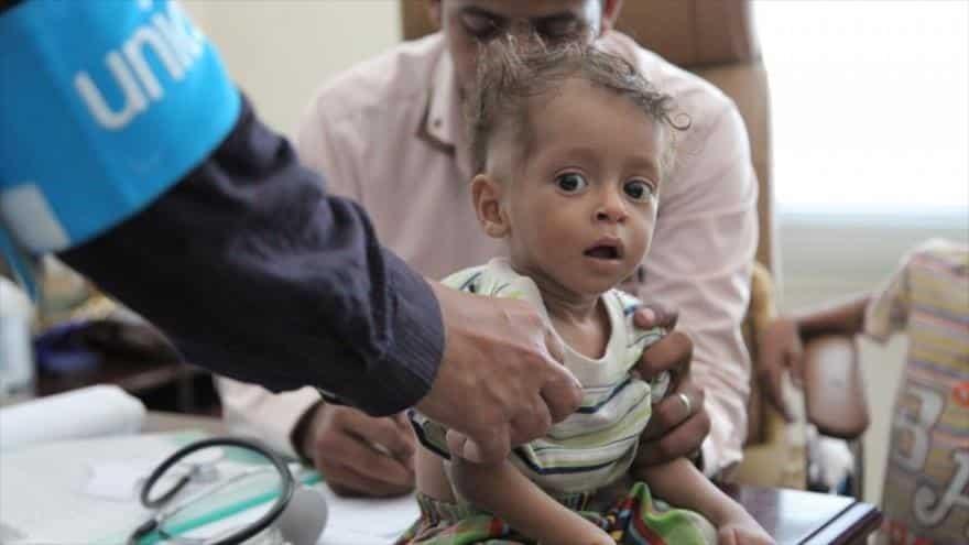 Está Yemen al borde de la hambruna Está Yemen al borde de la hambruna