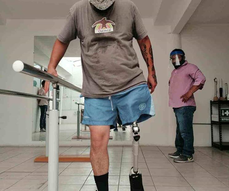 Así ayudan a personas con amputación