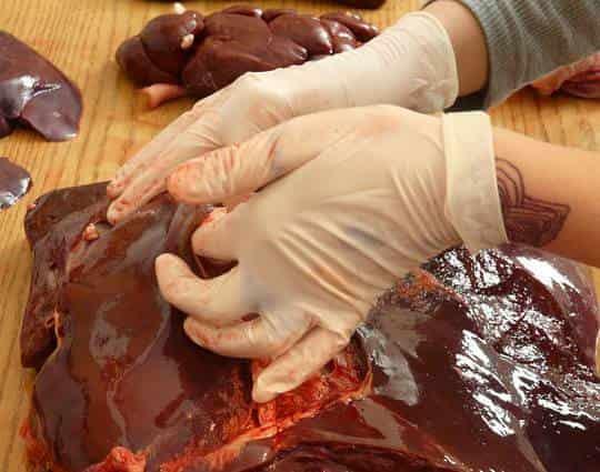 El hígado ayuda a combatir la anemia