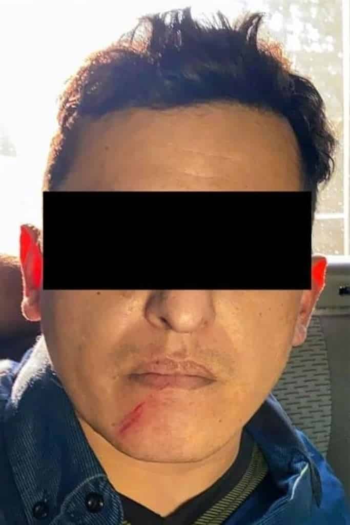 El médico veterinario que practicó la cesaría, fue notificado que el Juez de Control, determinó que sería sometido a proceso