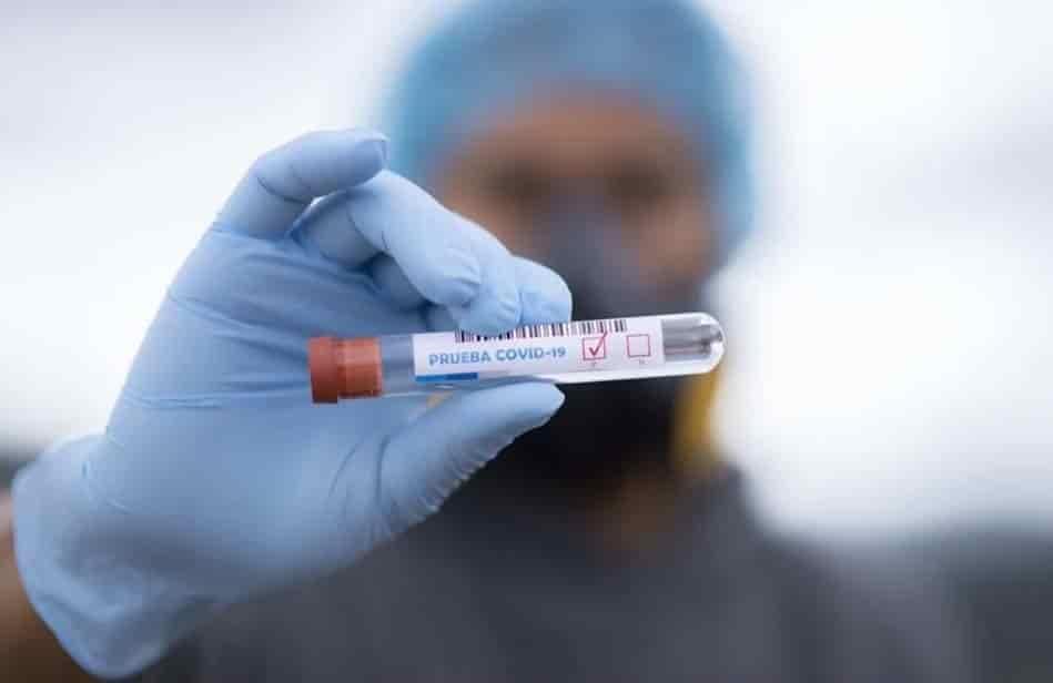 Nueva prueba detectaría anticuerpos de Covid-19 en segundos Nueva prueba detectaría anticuerpos de Covid-19 en segundos