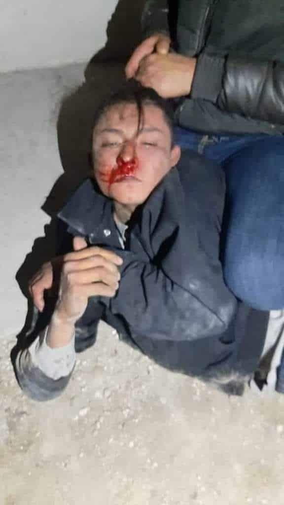 Golpean a presunto ladrón en El Carmen