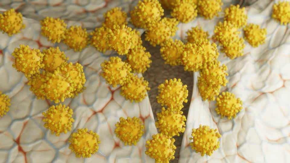 Covid-19 se relaciona con una inflamación viral en cerebro Covid-19 se relaciona con una inflamación viral en cerebro