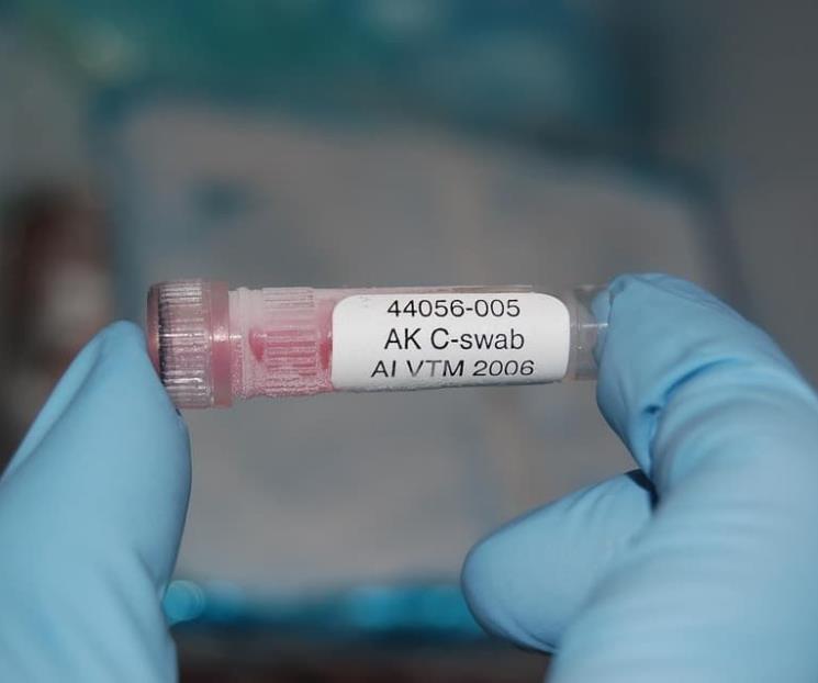 Detecta Rusia primeros casos de gripe aviar en humanos Detecta Rusia primeros casos de gripe aviar en humanos