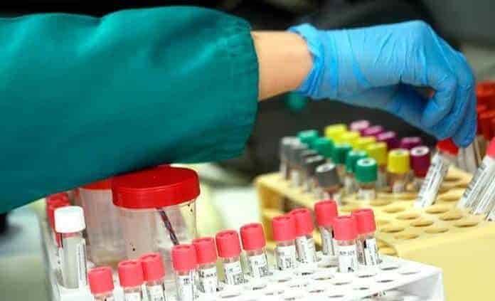 Ordenan dar a conocer pruebas de Covid  de funcionarios