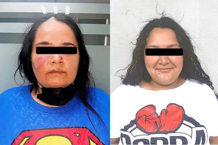 Arresta a mujeres por agredirse a golpes en vía pública