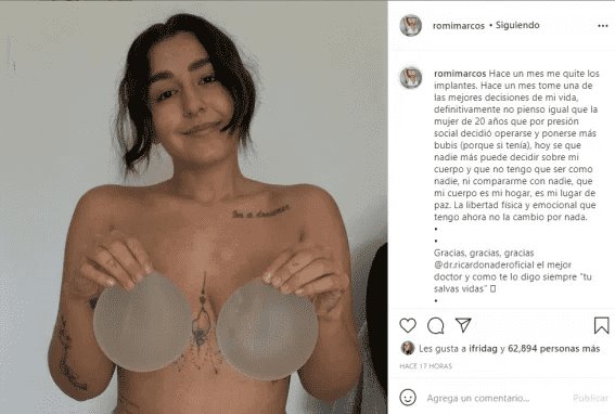 La hija de Niurka se quita los implantes de senos