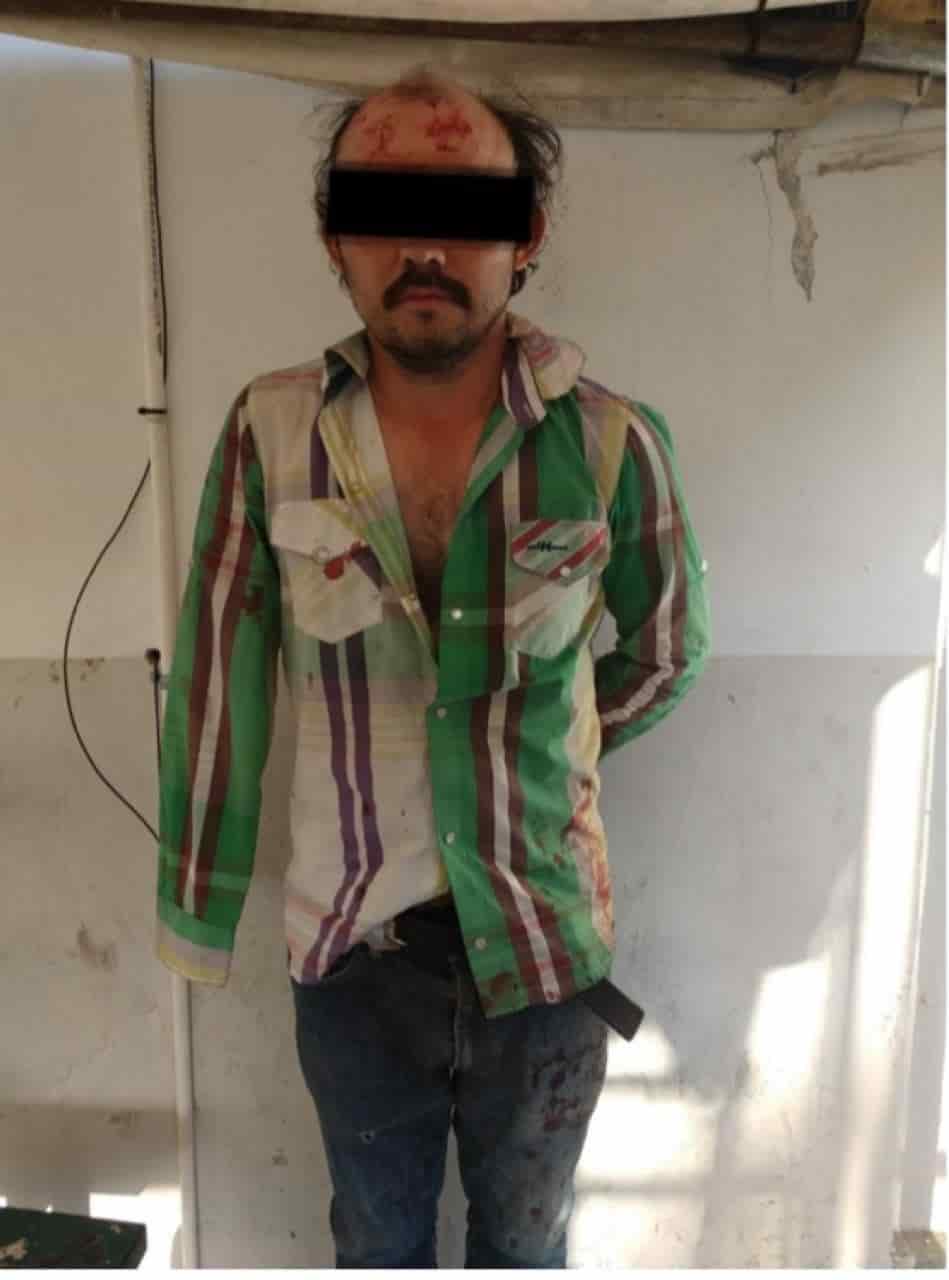 La carencia de su mano derecha no fue impedimento para que un hombre golpeara y acuchillar a su madre de 70 años de edad