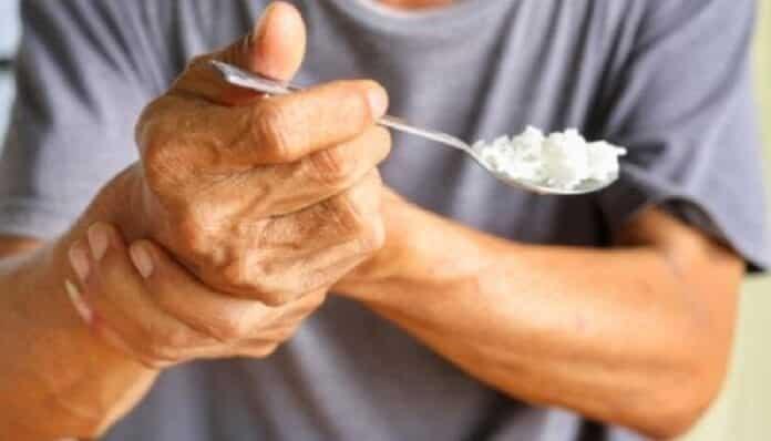 Disertarán sobre el Parkinson en pandemia