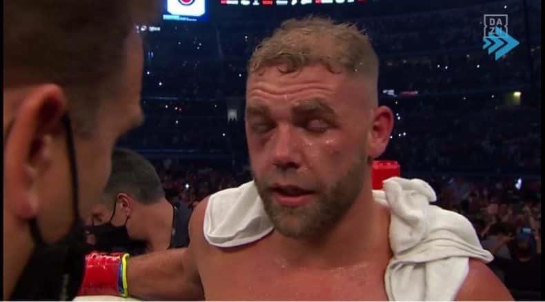 Reaparece Saunders: “Canelo’ me partió en tres la mejilla’