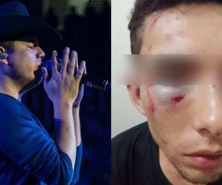 Remmy Valenzuela es acusado de violento Remmy Valenzuela es acusado de violento