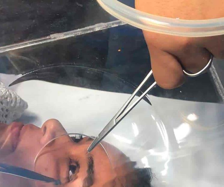 Profesores Tec diseñan dispositivo para oftalmología Profesores Tec diseñan dispositivo para oftalmología