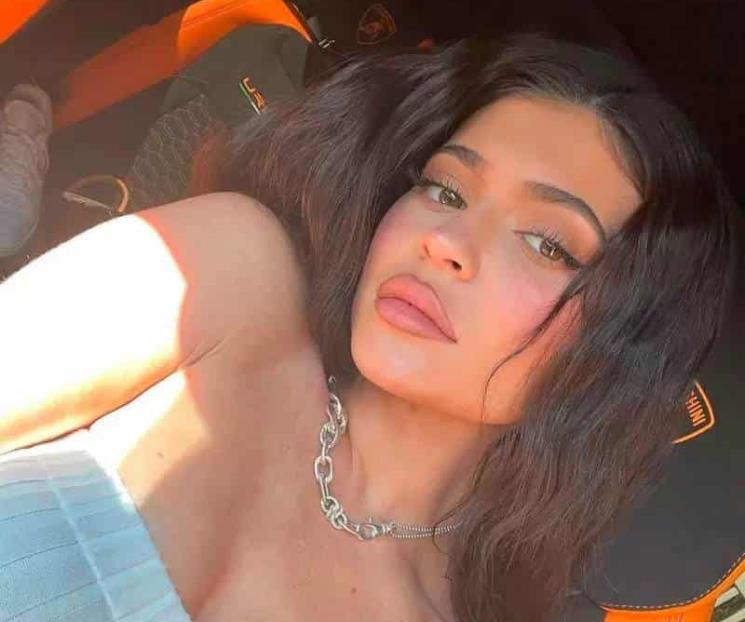 Kylie revela por qué empezó a rellenar sus labios Kylie revela por qué empezó a rellenar sus labios