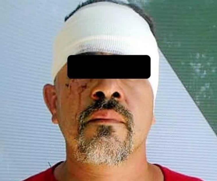 Hombre intenta quemar a su ex pareja en Apodaca Hombre intenta quemar a su ex pareja en Apodaca