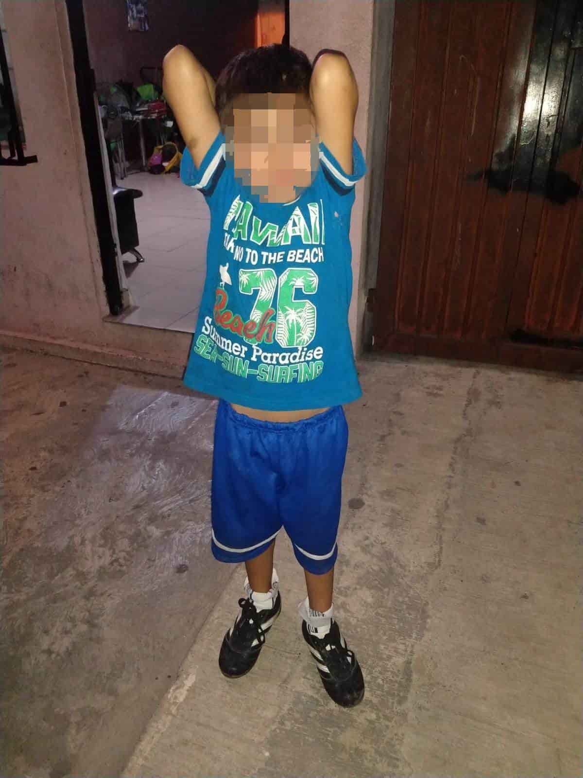 Localizan a menor de 7 años de edad con huellas de violencia y quien se encontraba solo en la vía pública
