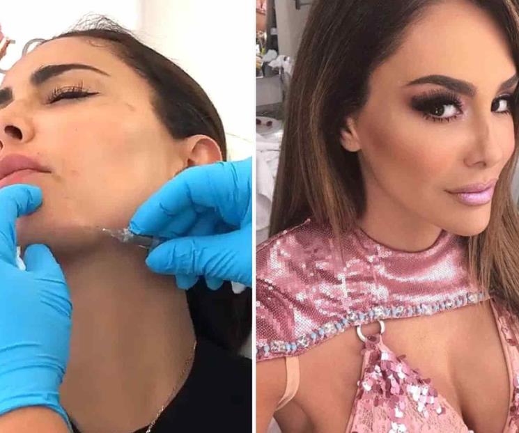 Habla Ninel Conde sobre sus cirugías estéticas