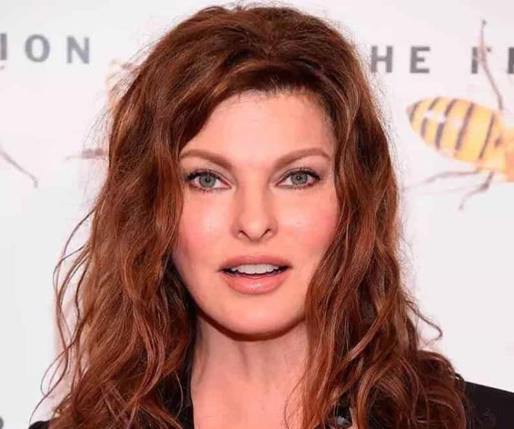 Linda Evangelista quedó desfigurada tras tratamiento