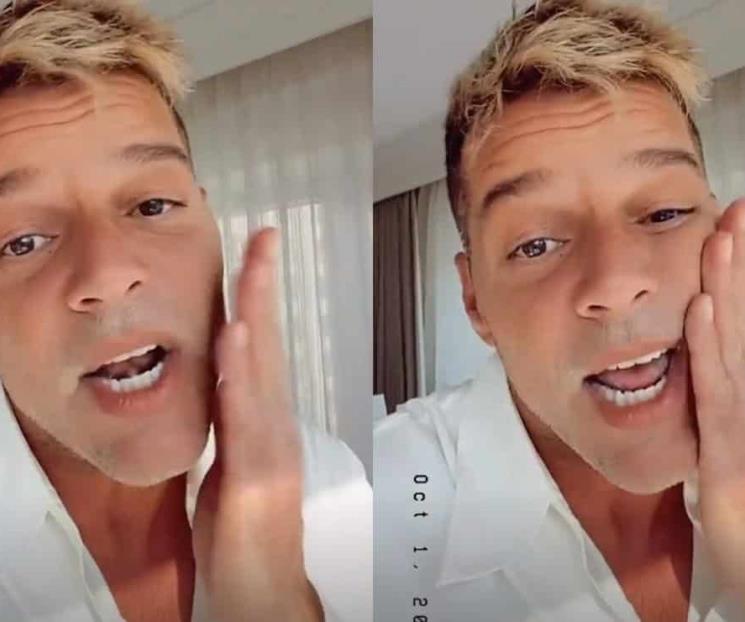 Ricky Martin explica lo que le pasó en su rostro