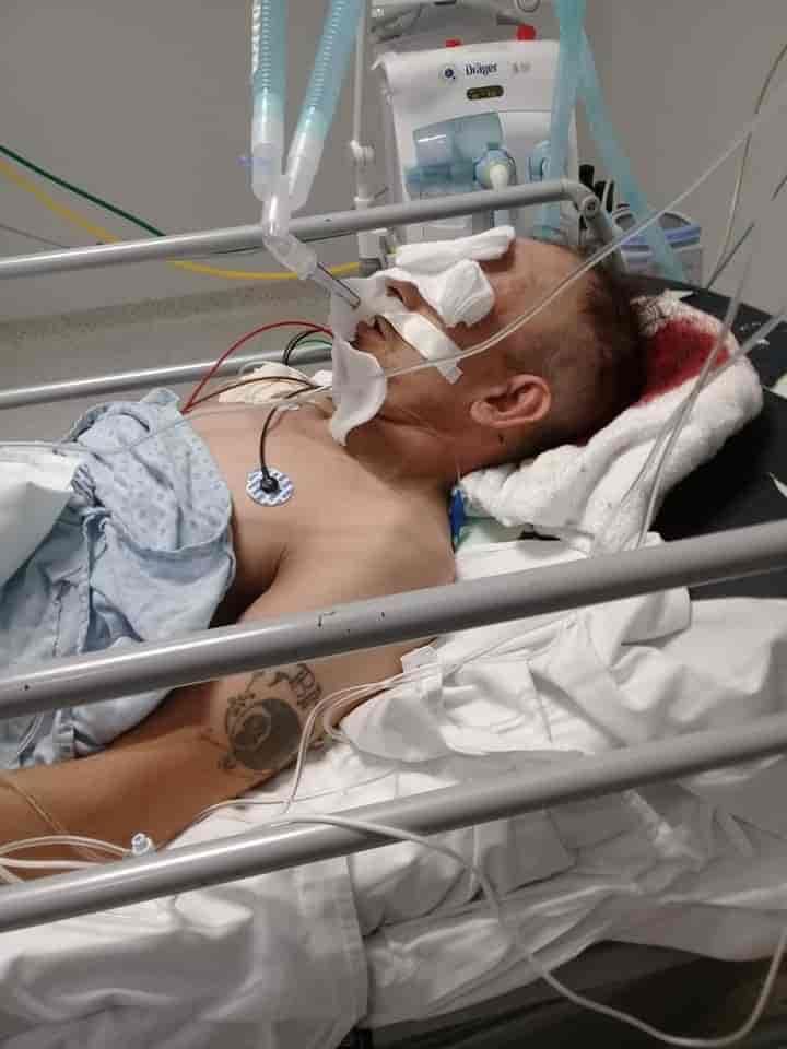 Golpea a hombre con bate y lo deja en estado de coma Golpea a hombre con bate y lo deja en estado de coma