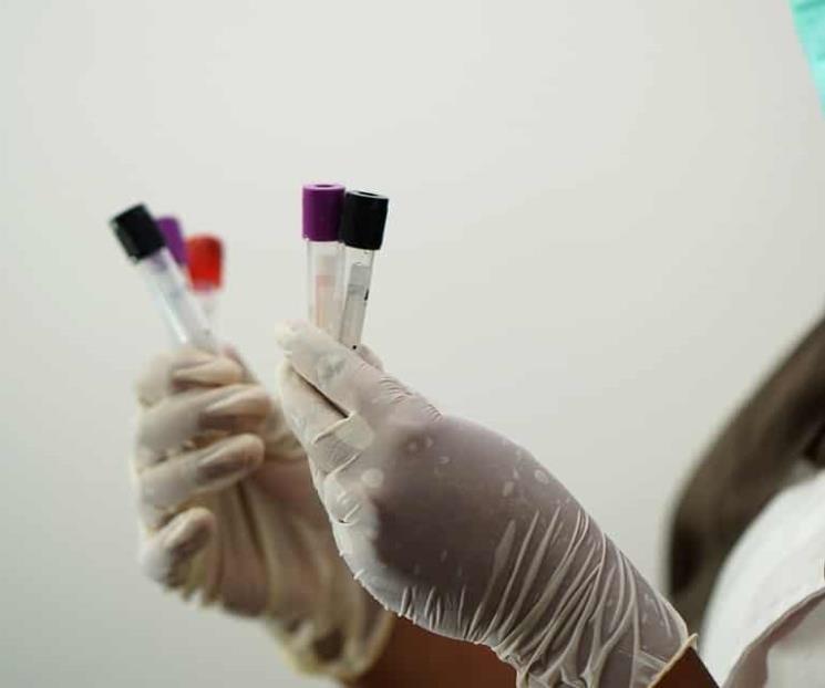 Encuentran frascos con viruela en refrigerador 