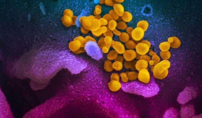 Científicos sugieren desenlace pandémico