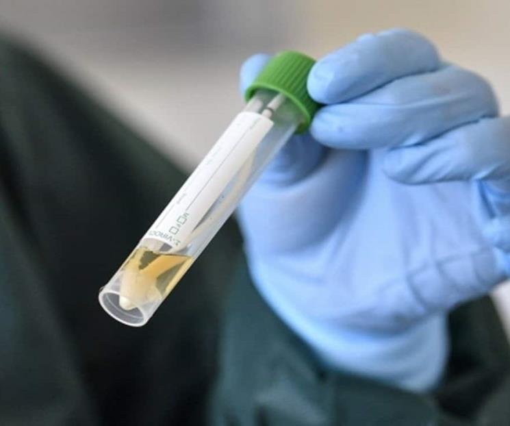 Descartan variante ómicron en sospechoso Covid de Sinaloa Descartan variante ómicron en sospechoso Covid de Sinaloa