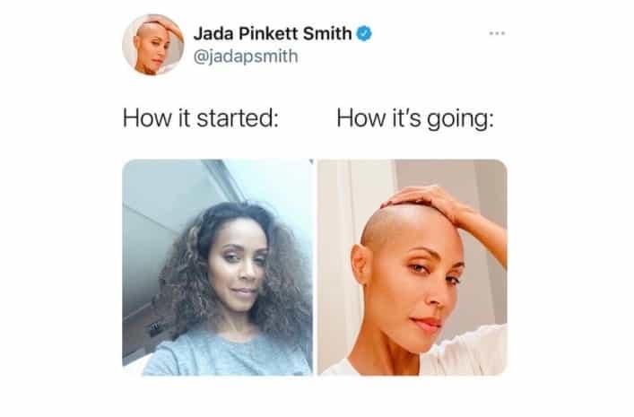 Jada Pinkett Smith hace las paces con su calvicie