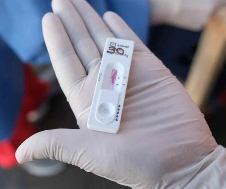 Alertan por uso de pruebas serológicas; no son eficientes