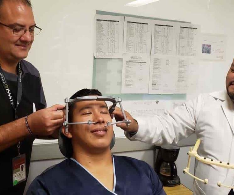 Unen esfuerzos para tratar deformidades craneales