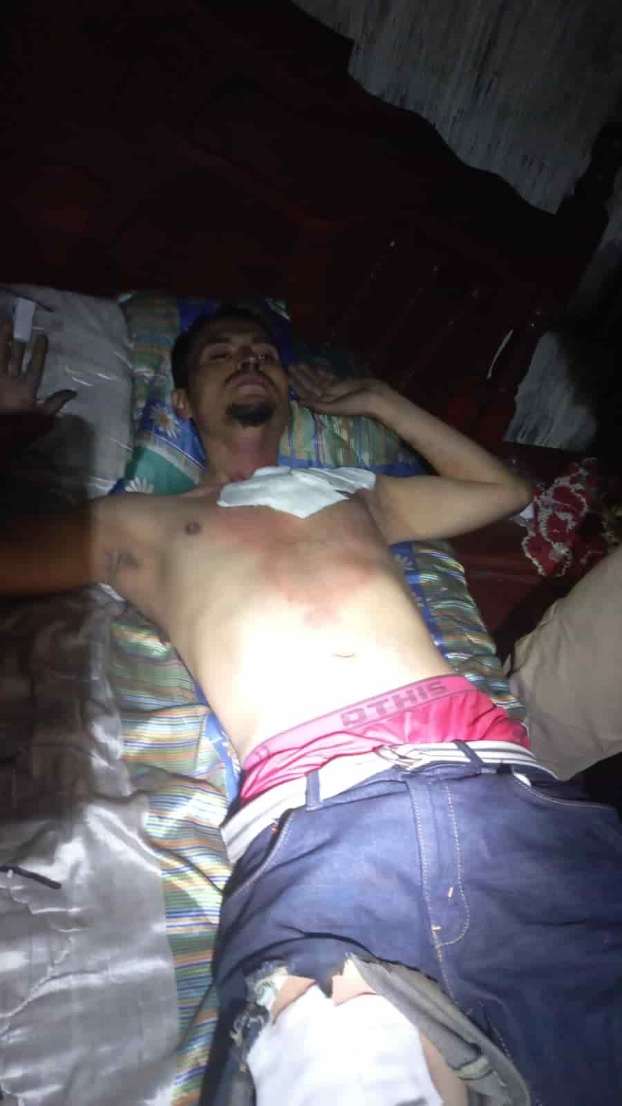 Un hombre aparentemente en estado de intoxicación ocasionó un incendio en su domicilio