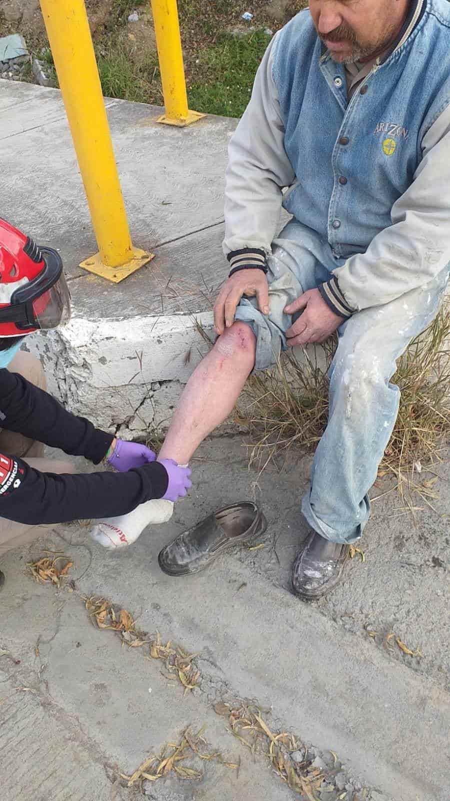 Un hombre de avanzada edad, terminó con diversas lesiones, al ser impactada su motocicleta