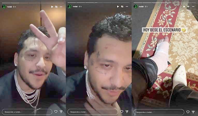 Sufre accidente en el escenario