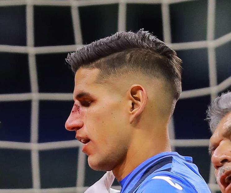 Vendrá Cruz Azul mermado ante Tigres