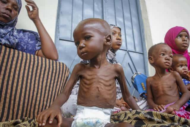 Causa hambre cientos de muertos en Somalia Causa hambre cientos de muertos en Somalia