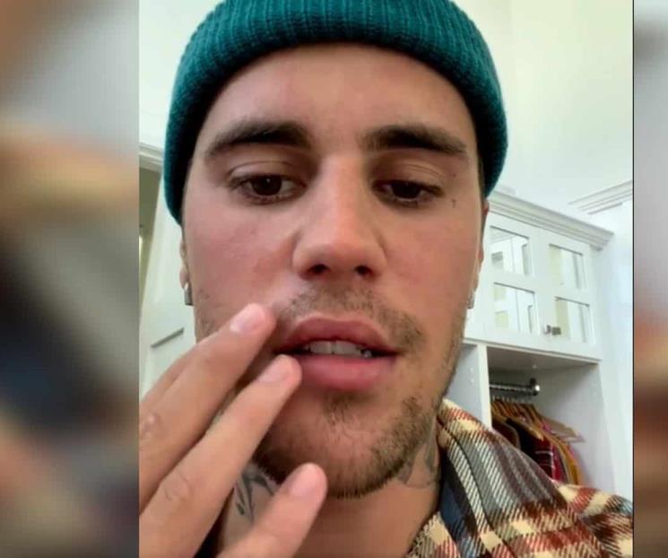 Revela Justin Bieber que tiene mitad del rostro paralizado