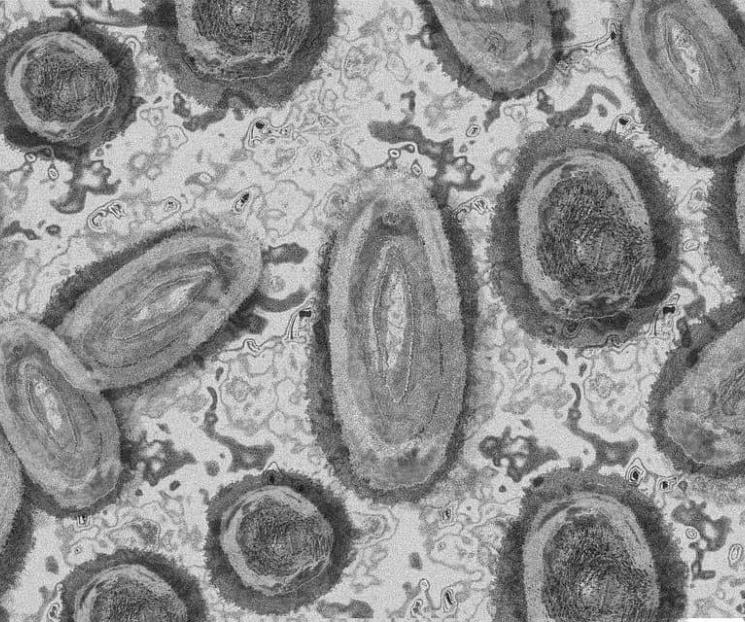 ¿Viruela del mono se transmite sexualmente?