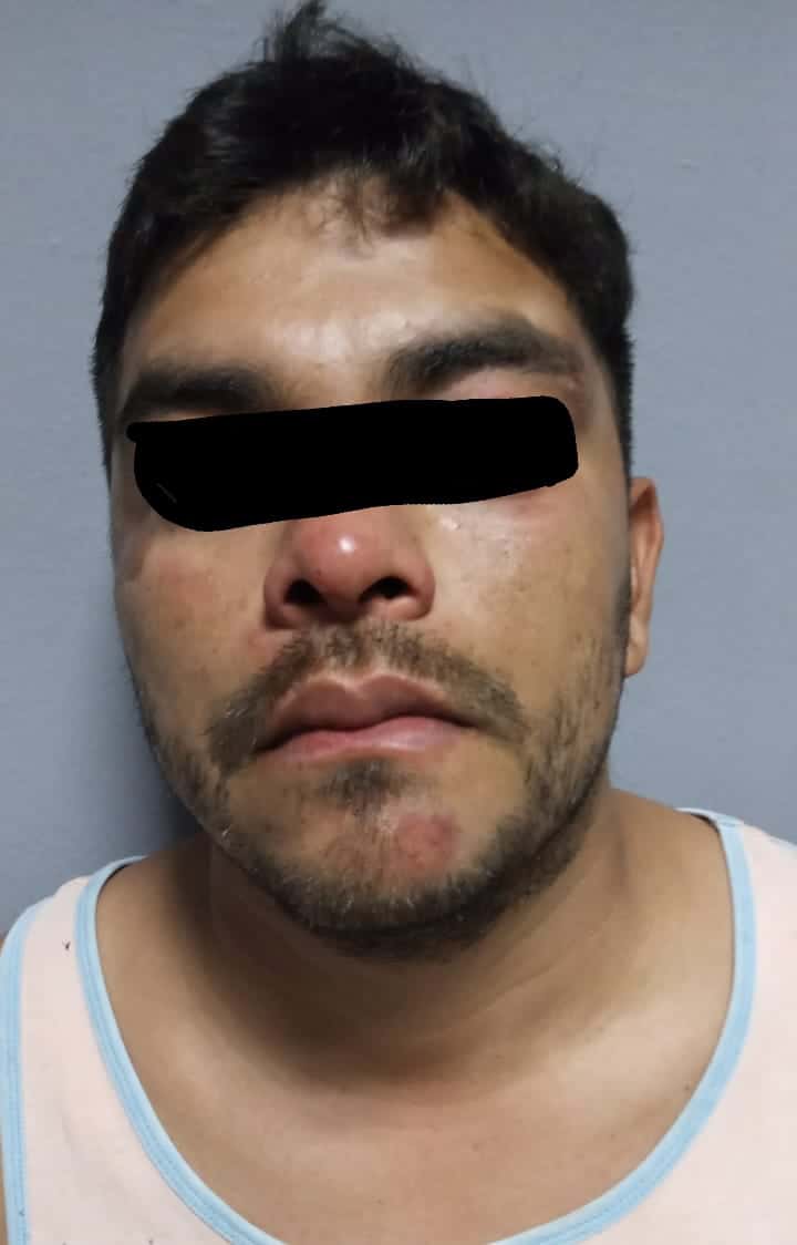 Luego de que le llamaron la atención por no traer casco, ni placas, un motociclista se molestó por la indicación y en compañía de sus vecinos agredió a un policía a quien lesionaron en el rostro