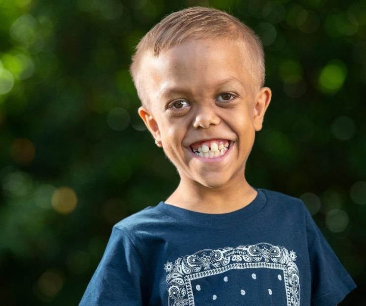 Quaden Bayles, de sufrir bullying a triunfar en Hollywood