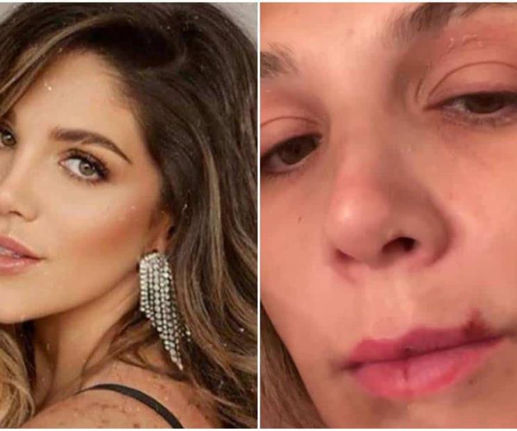Natalia Alcocer muestra la violencia de su expareja