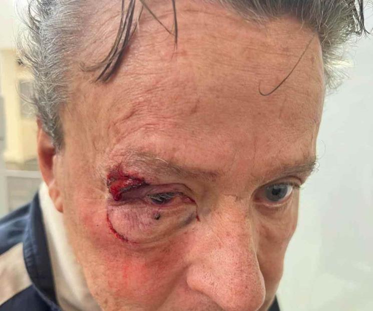Golpean a Alfredo Adame por intentar grabar a dos baleados Golpean a Alfredo Adame por intentar grabar a dos baleados