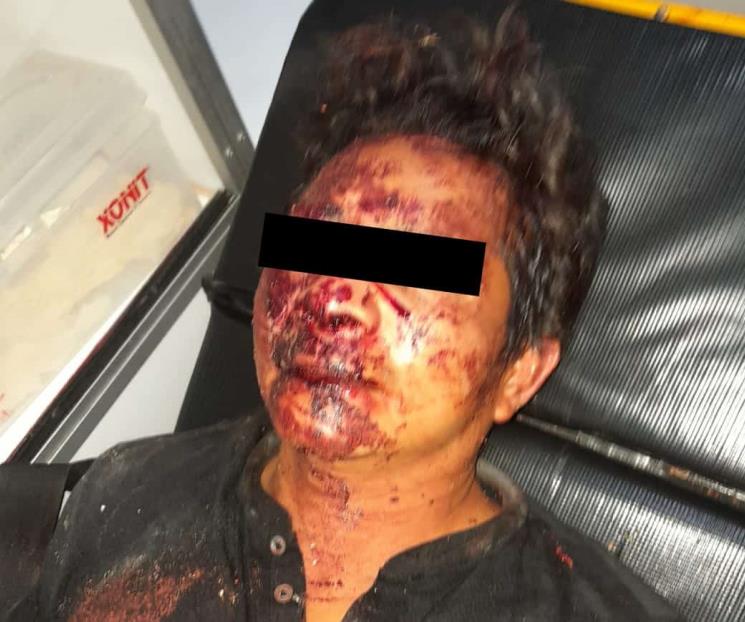 Propinan golpiza vecinos a hombre agresor
