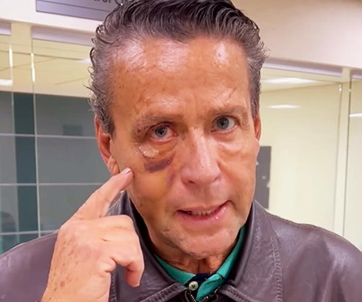 Alfredo Adame fue operado de emergencia Alfredo Adame fue operado de emergencia