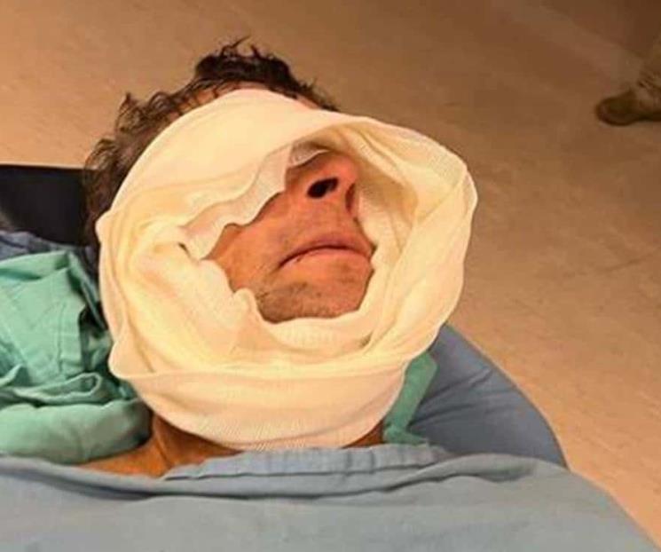 Así quedó Alfredo Adame tras cirugía Así quedó Alfredo Adame tras cirugía