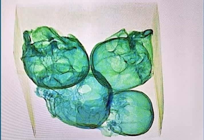 Hallan cráneos en aeropuerto Hallan cráneos en aeropuerto