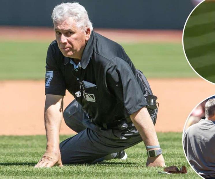 Umpire de GL es evaluado por golpe en cabeza