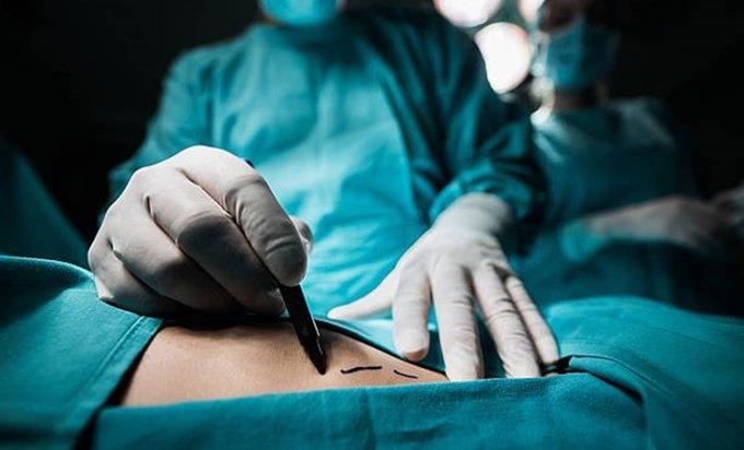 Cirujano acusado de negligencia seguirá operando en Sinaloa