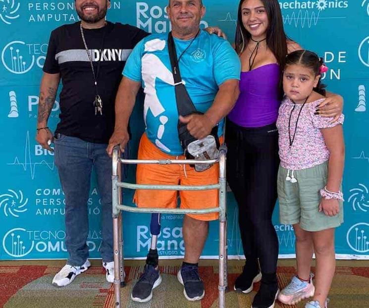 Tec GDL reúne a comunidad de personas con amputación