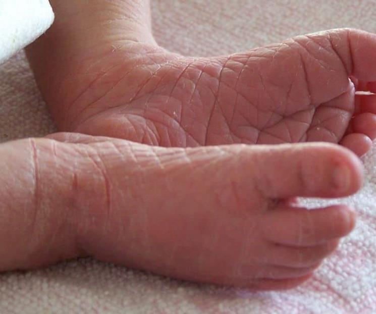 ¿Cómo viven las personas con piel de mariposa? ¿Cómo viven las personas con piel de mariposa?