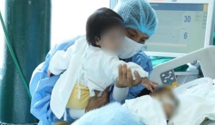 Separan con éxito a siameses en Perú