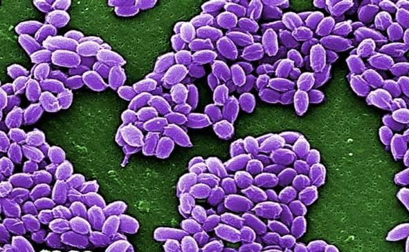 Qué es un brote de ántrax por el que la OMS emitió una alerta